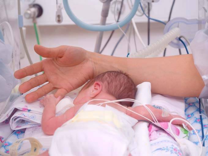 bebés prematuros 3