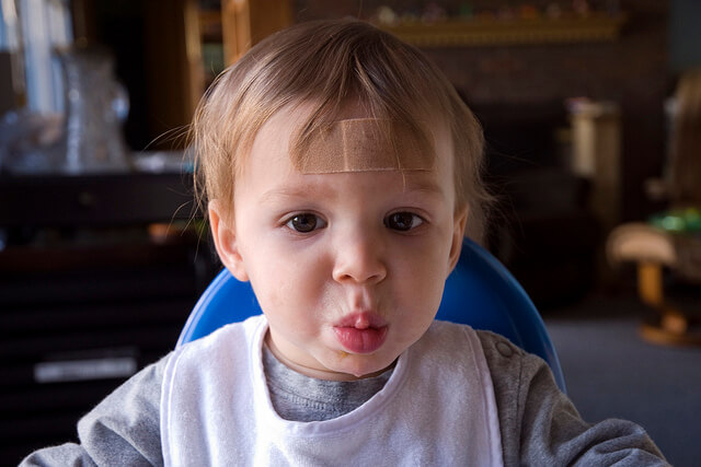 Consejos para disimular las cicatrices de los niños