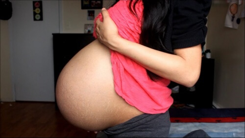 Cuidados de la mujer en embarazos múltiples