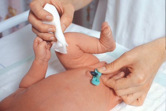 ¿Cómo cuido el cordón umbilical de mi bebé?