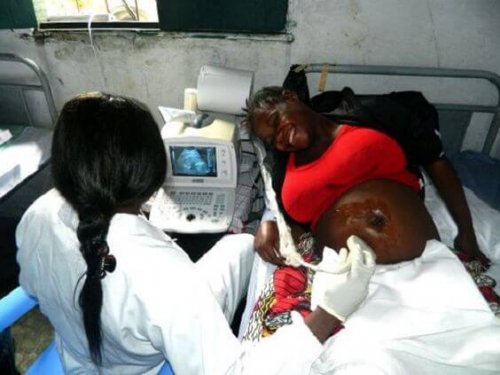 Sorpresa ante una ecografía en El Congo