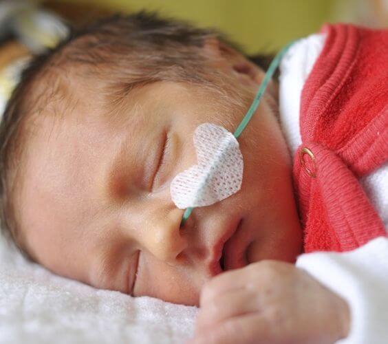 Sorprendentes casos de bebés prematuros