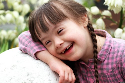 o-SINDROME-DE-DOWN-facebook