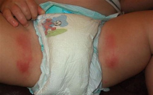 00569d24406a91c584c7600e6989b25a