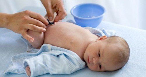 curando ombligo del bebé