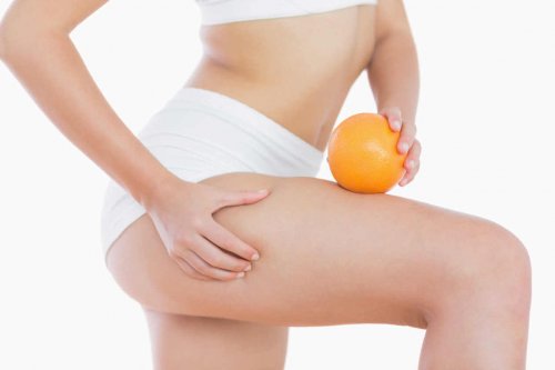 Las piernas y glúteos son las partes donde es más frecuente la celulitis después del embarazo. 