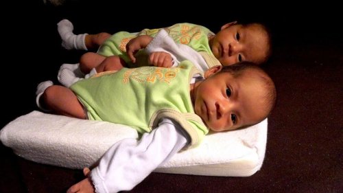 Bebês gêmeos: reabsorção de embriões