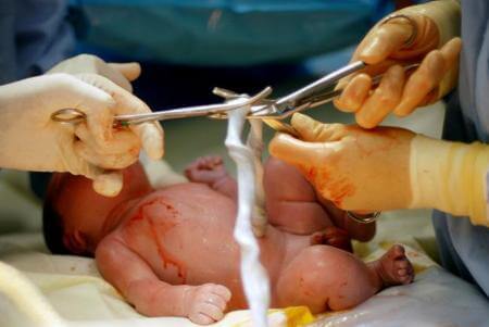 Muchos médicos recomiendan esperar para cortar el cordón umbilical tras el nacimiento.