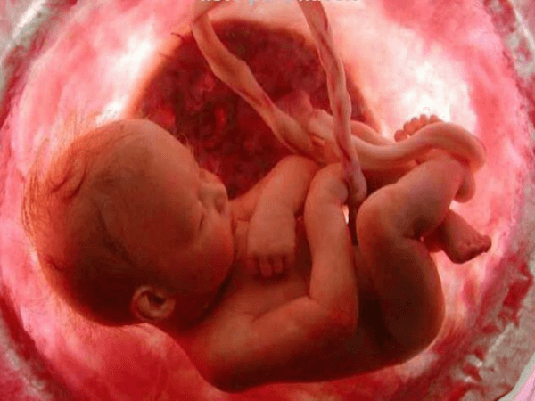 Un foetus dans la poche utérine. 