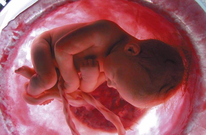 placenta, cordón y saco 2