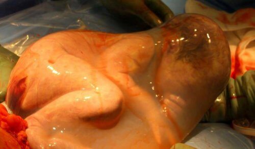 Bebés enmantillados: la magia de un nacimiento especial