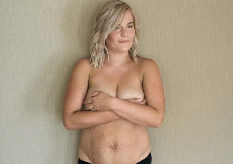 Una madre muestra su cuerpo tras dar a luz en defensa de la belleza del cuerpo femenino