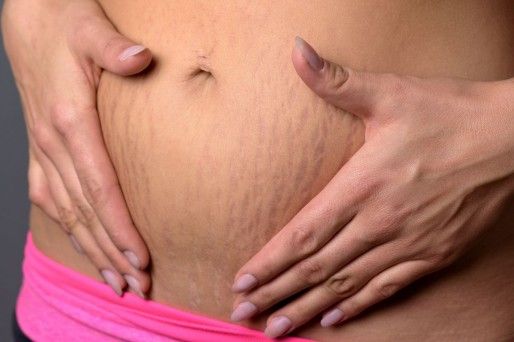 ¿Es posible un embarazo que no deje huellas?