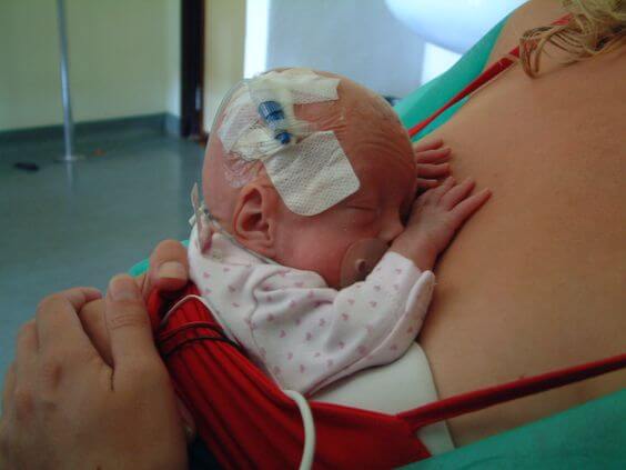 Las consecuencias de no amamantar a un bebé prematuro