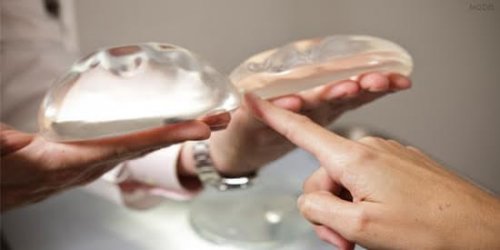 Lo que debes saber de implantes de mamas y la lactancia