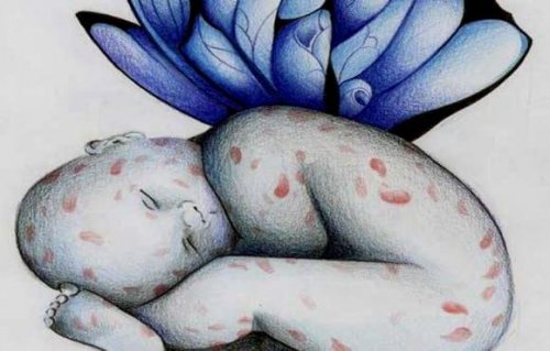 La enfermedad de los niños con piel de mariposa