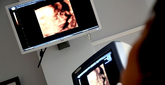 Las señales de sufrimiento fetal se pueden evidenciar a través de una ecografía.