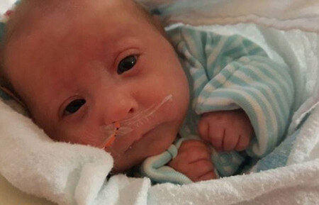 matthew bebé con enanismo