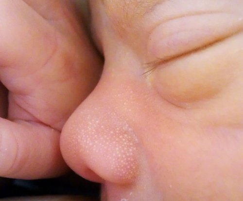 Un nouveau-né avec du mucus.
