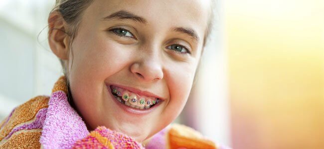 9 mitos y verdades de la ortodoncia
