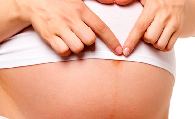 La línea alba, la "mágica" marca del embarazo