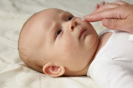 Een baby met vlekjes op de huid