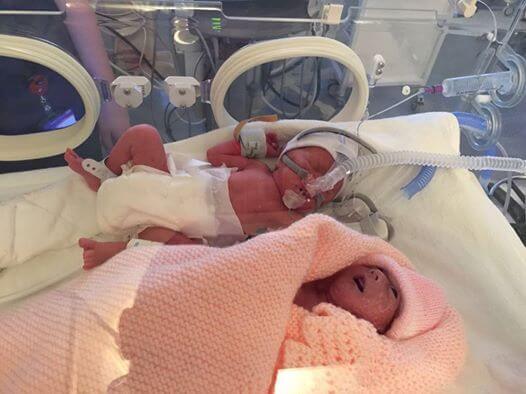 Newborn twins in an incubator.