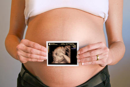 placenta, cordón y saco 1