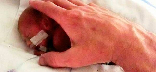 Descubre la historia del bebé más prematuro del mundo
