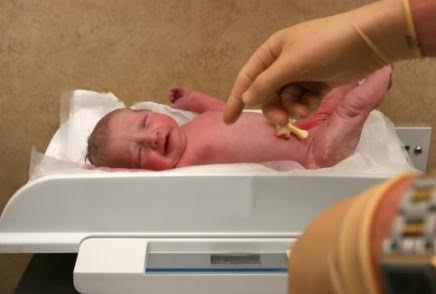 La perdida de peso en el recién nacido