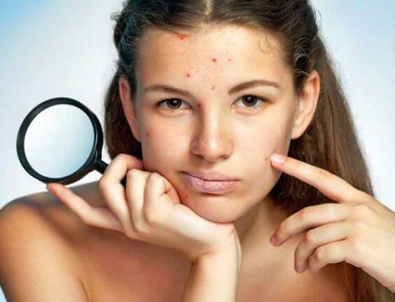 Cómo ayudar a tu hijo adolescente para que no se sienta el “patito feo”