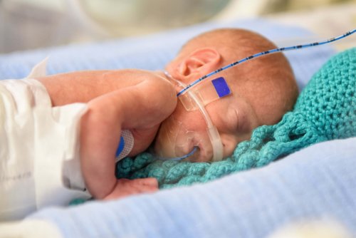 Una noticia maravillosa: cada vez más prematuros extremos salen adelante