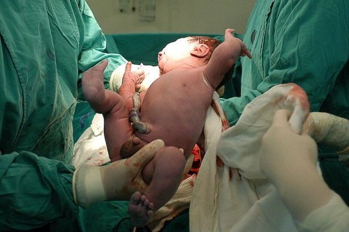 6 Cuidados que recibe el bebé justo después de nacer