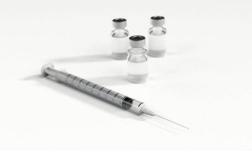 8 preguntas sobre la epidural