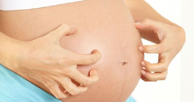 Consejos para tratar el picor del cuerpo durante el embarazo