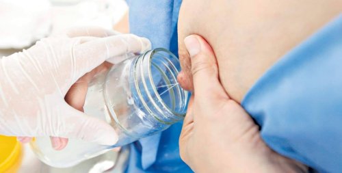 Todo lo que debes saber sobre la leche de donantes