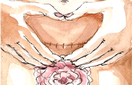 Nacer por cesárea también es una forma "sagrada" de llegar al mundo