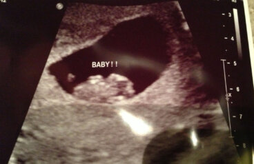 El logro del método Ramzi para conocer el sexo del bebé