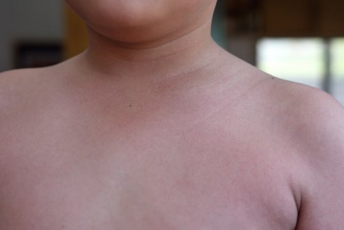 Le torse d'un enfant.