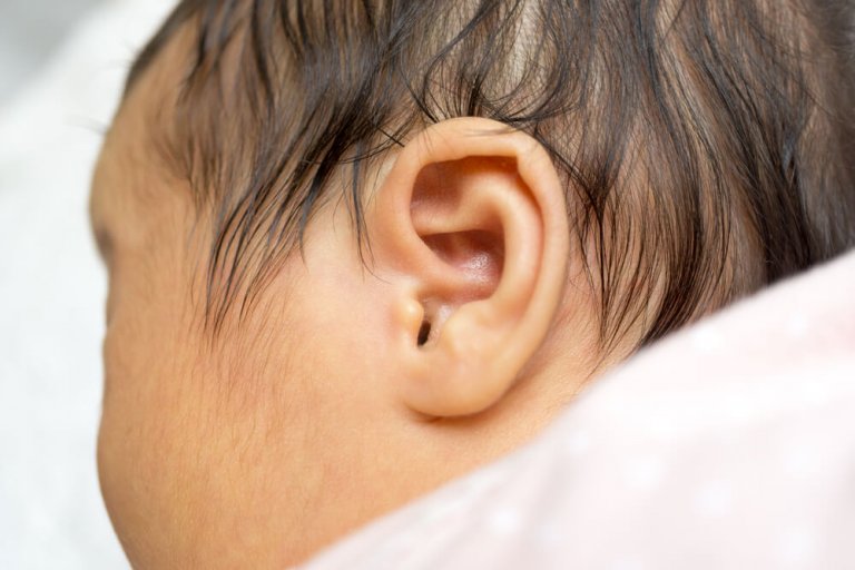 La detección precoz de la sordera en el recién nacido