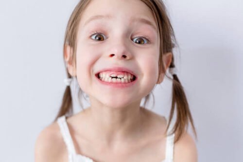 A little girl smiling and showing her 2 front adult teeth coming in.