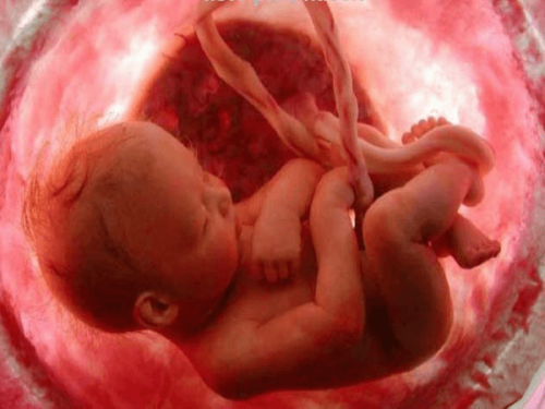 Efectivamente, la postura del feto indica cómo será tu parto, por lo que es mejor que tu bebé adopte posiciones cefálicas.