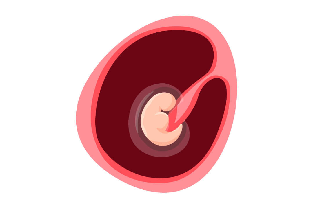 Bebé en la semana 4 de embarazo