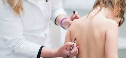 Escoliosis en niños: todo lo que debes saber