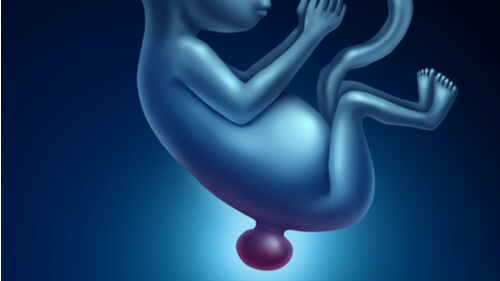 Bebés que nacen con la espina bífida