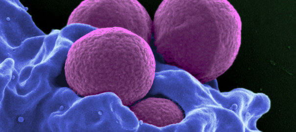 neutrófilos bajos en el bebé