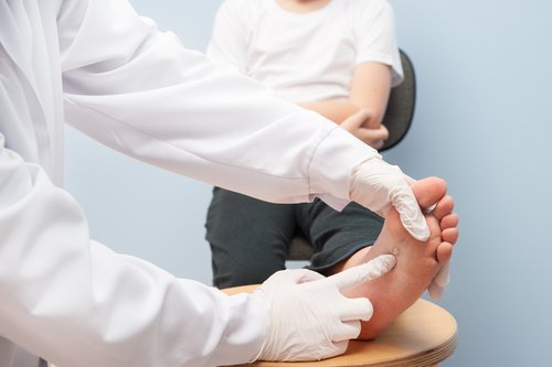 Verrugas en niños: causas, tipos y tratamiento