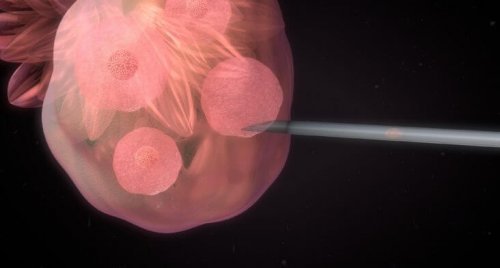 La inseminación artificial: en qué consiste y cómo de accesible es