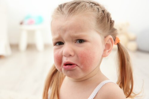 Alergias alimentarias en niños