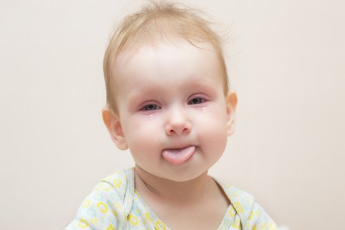 Otro síntoma típico de la conjuntivitis en bebés, además de la inflamación, es la secreción de una especie de mucosa.